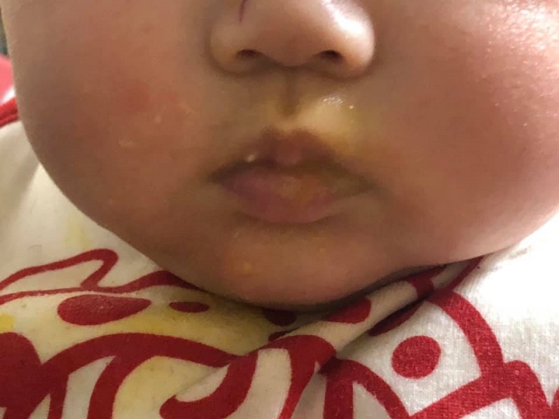 離乳食始まりました